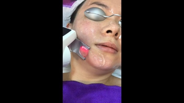 laser treatment being carried out on a patient