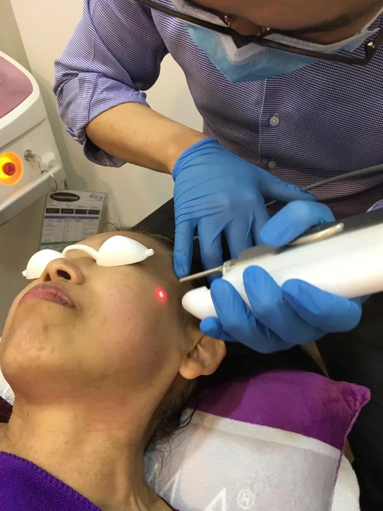 Laser Treatment for Skin Pigmentation by Aesthetic Doctor, Heng Wee Soon, The Ogee Clinic