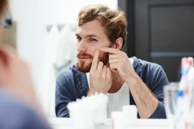 Man squeezing his pimple