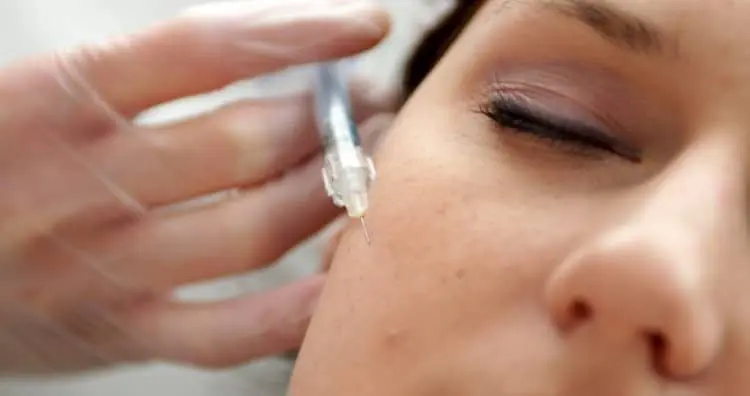 Preventive Botox