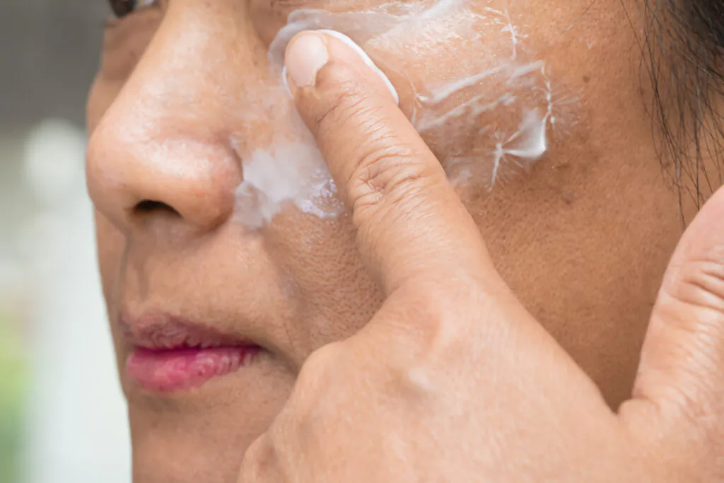 Topical medicated creams used for melasma treatment
